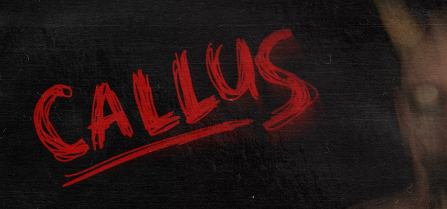CALLUS FREE Giveaway